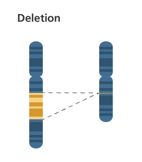 Simple & clear diagram showing a chromosome deletion, when part of the chromosome is missing. This is part of our illustration series depicting chromosome abnormalities in an easy-to-understand schematic way. Chromosome Deletion, Chromosome Structure, Chromosomal Disorders, Biology Genetics, Chromosomal Abnormalities, Biology Worksheet, Differently Abled, Case Presentation, Stain Techniques