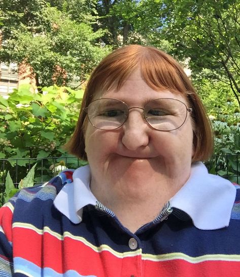 Trolls Tell Woman She’s ‘Too Ugly’ To Be Posting Pics Of Her Face, She Responds With 3 Selfies | Bored Panda Melissa Blake, Ugly Photos, Best Marriage Advice, Disabled People, Funny Profile, Funny Face, Good Marriage, New Teachers, Brain Health