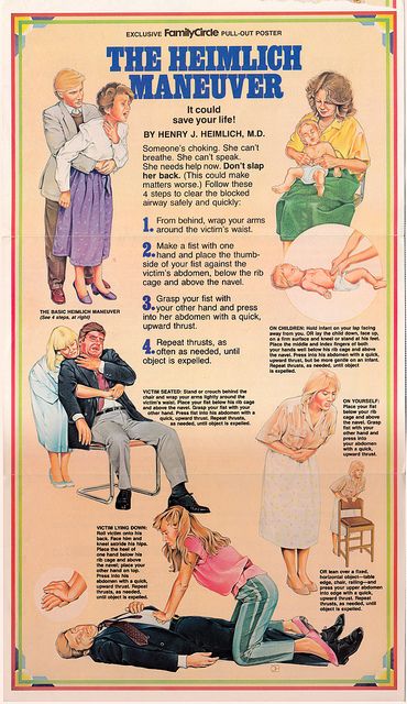 vintage heimlich maneuver poster http://www.pinterest.com/sthomas68/occupational-and-physical-therapy/ Heimlich Maneuver, First Aid Cpr, First Aid Tips, Emergency First Aid, Emergency Medicine, Survival Life, Medical Knowledge, Emergency Prepping, Medical Education