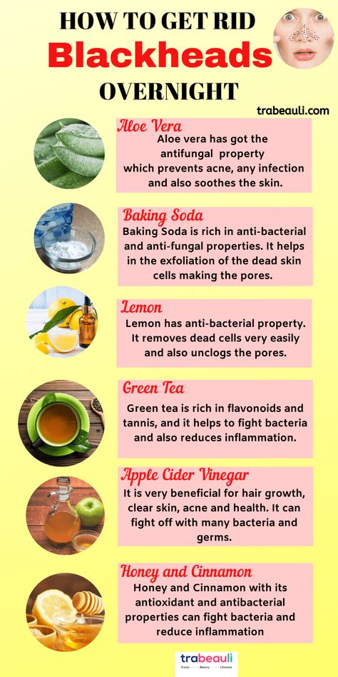 How To Remove Blackheads At Home Permanently – Best Beauty Lifestyle Blog How To Remove Blackheads, Blackhead Remedies, To Remove Blackheads, Rid Of Blackheads, Cold Medicine, Remove Blackheads, Home Remedy For Cough, Cold Sores Remedies, Natural Health Care