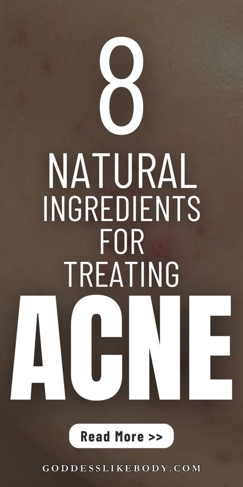 Explore 8 useful ingredients for naturally treating acne, from tea tree oil to aloe vera. Discover how these natural remedies can help improve your skin and combat breakouts effectively. Nature, Natural Treatments, Treat Acne Naturally, Acne Medicine, Natural Acne Remedies, Acne Breakout, Acne Remedies, Best Oils, How To Treat Acne