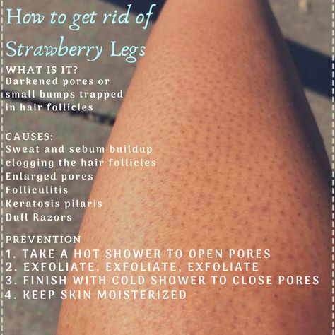 How To Clear Strawberry Legs At Home, How To Get Rid Off Strawberry Skin, How Get Rid Of Strawberry Skin, How To Get Rid Of Strawberry Skin Diy, How To Get Rid Of Dry Leg Skin, Tips For Strawberry Skin, How Do You Get Rid Of Strawberry Skin, How To Shave Ur Legs Properly, How To Get Rid Strawberry Skin