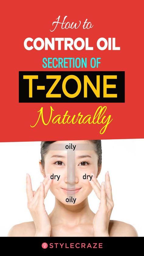Oil Control, T Zone, Oily T Zone, Normal Skin Type, Skin Care Routine For 20s, Face Care Tips, How To Get Rid Of Pimples, Moisturizer For Oily Skin, Skin Care Steps