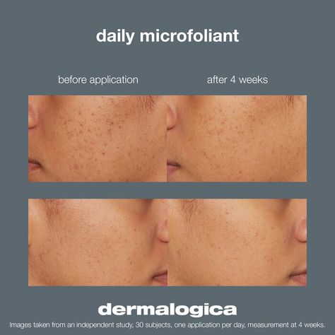 Skin Care, Dermalogica Aesthetic, Daily Microfoliant, Dermalogica Daily Microfoliant, Clogged Pores, Esthetician, Sephora, Bath And Body, Lookbook