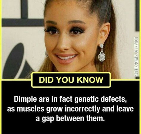 Lovely defect Humour, Science Facts Mind Blown, Physcology Facts, Physiological Facts, Psychological Facts Interesting, Biology Facts, Interesting Science Facts, Brain Facts, True Interesting Facts