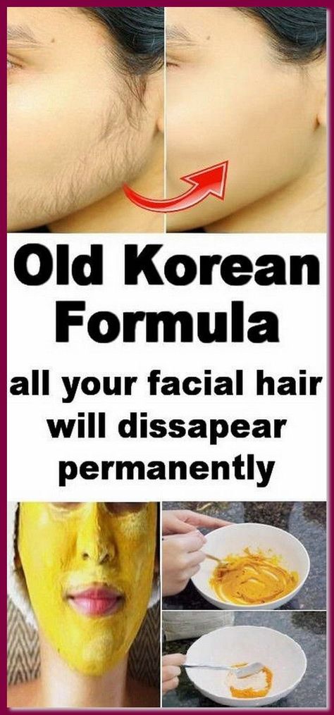 Permanent Facial Hair Removal, Face Hair Removal, Unwanted Hair Permanently, Unwanted Hair Growth, Diy Pinterest, Underarm Hair Removal, Unwanted Facial Hair, Facial Hair Removal, Hair Removal Cream