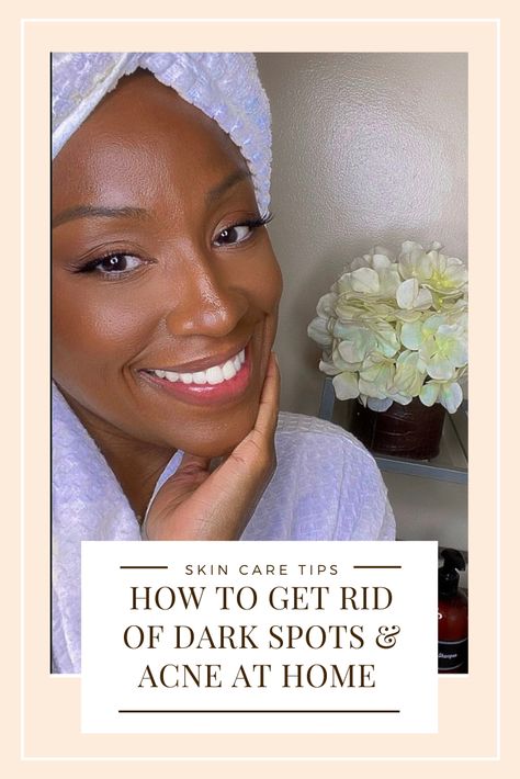 Chicago. Black esthetician. Kiki Carr. Optimal Beauty. Facials. Skin Care. Diy Skin Peel At Home, Skin Care For Black Skin, Home Skin Care Routine, At Home Skin Care, Oily Acne Prone Skin, Collagen Skin Care, Get Rid Of Dark Spots, Home Skin Care, Oily Skin Makeup