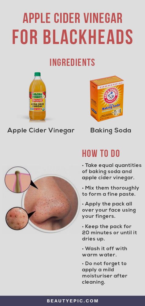 Can Apple Cider Vinegar Help You Get Rid Of Blackheads? Rid Of Blackheads, Apple Vinegar, Canned Apples, Organic Apple Cider, Get Rid Of Blackheads, Lose 40 Pounds, Healthy Eating Habits, Blackhead Remover, Cider Vinegar