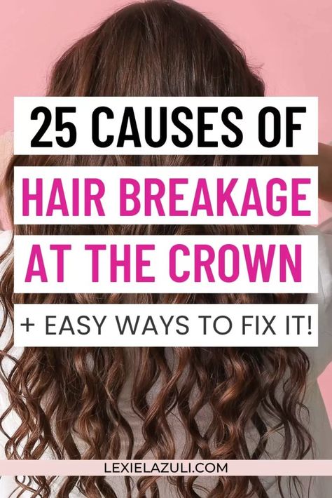 Cause Of Hair Fall, Help Hair Breakage, Reduce Breakage Natural Hair, How To Keep Your Hair Out Of Your Face, Haircut For Breakage, How To Reduce Hair Breakage, How To Repair Hair Breakage, Prevent Hair Breakage Tips, How To Fix Breakage In Hair