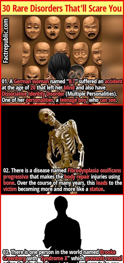 Paranormal Facts, World History Facts, Rare Genetic Disorders, Wierd Facts, Fact Republic, Rare Disorders, Science Fact, True Interesting Facts, Multiple Personality