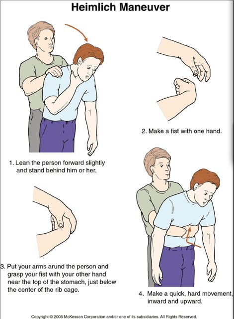 Heimlich maneuver - for adults, children, infants, pregnant women, yourself & your pets | GODYEARS Heimlich Maneuver, First Aid Cpr, First Aid Tips, Emergency First Aid, Survival Life Hacks, Survival Life, Girls Camp, Disaster Preparedness, Cub Scouts