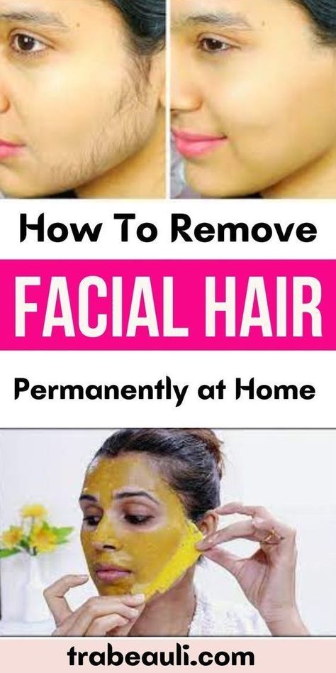 How To Remove Facial Hair Natural Permanently Natural Facial Hair Removal, To Remove Facial Hair, Permanent Facial Hair Removal, Remove Facial Hair, Best Facial Hair Removal, Face Hair Removal, Unwanted Hair Permanently, Remove Unwanted Facial Hair, Unwanted Facial Hair