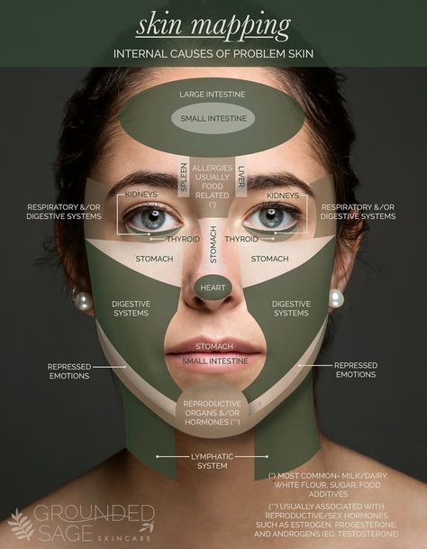 Acne Zones Face Mapping, What Breakouts Mean Face Mapping, Pimple On Face Reason, Location Of Pimples Meaning, Spot Mapping Face, Spot Face Map, Acne Causes On Face Chart, Acne Reasons Face Mapping, Pimple On Nose Meaning