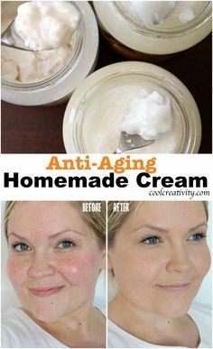 Simple Ingredients for Homemade Anti-Aging Cream                                                                                                                                                                                 More Anti Aging Face Mask Diy, Homemade Anti Wrinkle Cream, Diy Anti Aging Cream, Dry Oily Skin, Anti Aging Homemade, Oily Skin Acne, Lotion For Oily Skin, Skin Cream Anti Aging, Eye Skin Care