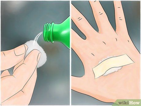 3 Ways to Reduce the Pain of Gnat Bites - wikiHow Insects, Gnat Bites, How To Get Rid Of Gnats, Bite Relief, Tree Sap, Body Of Water, Bug Bites, Flying Insects, Insect Bites