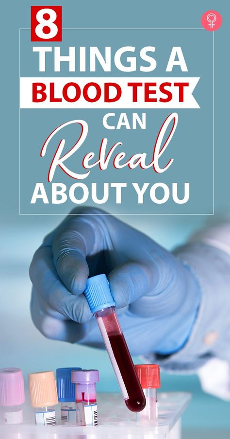 8 Things A Blood Test Can Reveal About You: Following are 8 surprising things still under development, which your blood test could reveal about you. #bloodtest #trending Iq Test Questions, Test Your Iq, Lab Image, Test For Kids, Pathology Lab, Brain Test, Med School Motivation, Brain Scan, Test Quiz