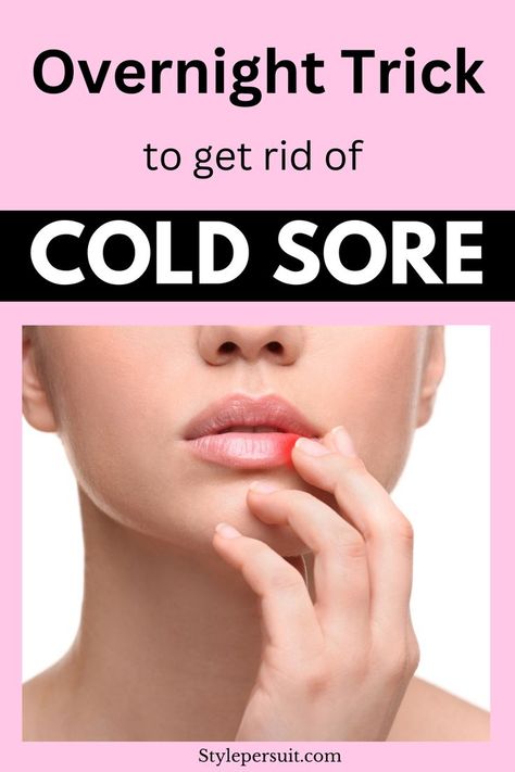 Here are the best cold sore remedies to alleviate symptoms and speed up healing, as well as prevention tips to help reduce the chances of future outbreaks. Heal Fever Blister Fast, How To Heal A Cold Sore Fast, Natural Remedies For Cold Sores, How To Prevent Cold Sores, Cold Sores Remedies Overnight, How To Get Rid Of Cold Sores, How To Get Rid Of Cold Sores Overnight, Canker Sore Remedy Overnight, Cold Sore Remedy Quick Overnight