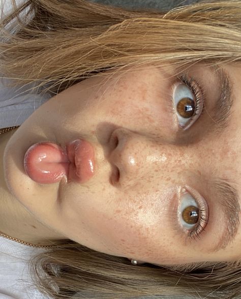 Freckles Placement, Blonde Brown Eyes Girl, Freckle Inspiration, How To Get Freckles Naturally In The Sun, Cute Freckles Aesthetic, Freckle Placement, Blond With Brown Eyes, Full Body Freckles, Freckles On Dark Skin