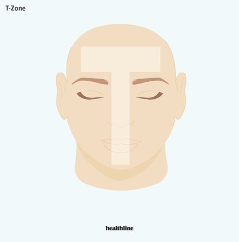 T-Zone Face: What to Do for an Oily, Acne-Prone T-Zone T Zone Oily Skin Care, T Zone Acne, Inflamed Pimple, T Zone, Green Tea Toner, Oily T Zone, Forehead Acne, Pimples On Face, Skin Undertones