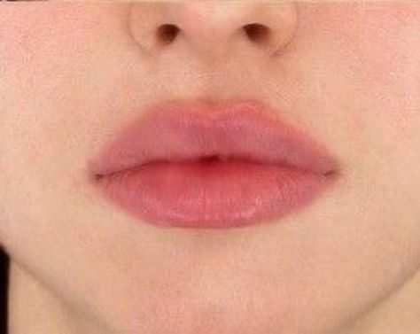 Lips Inspiration, Lips Photo, Perfect Lips, Beauty Goals, Lip Fillers, Dream Body, Perfect Body, Beauty Face, Plastic Surgery