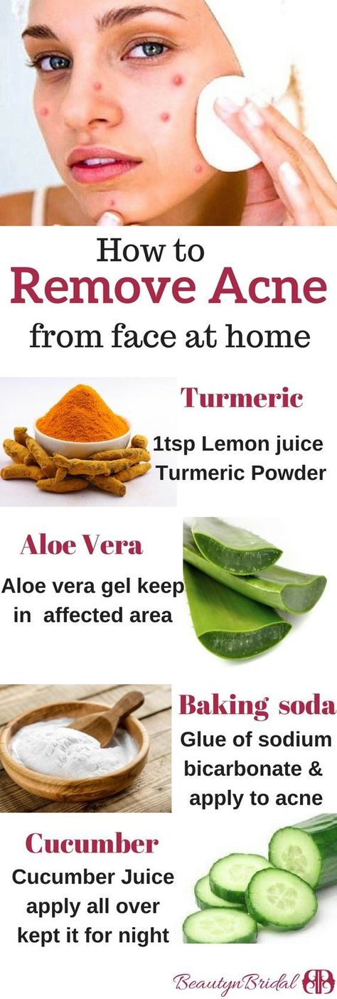 Remove Acne Marks and Other Skin Scars With These Simple and Effective Home Remedies! #diypimpletreatment Remove Acne Marks, Doterra Acne, Pimple Scars, Pimple Marks, Home Remedies For Pimples, Pimples Overnight, Pimples Remedies, Skin Care Routine For 20s, Get Rid Of Acne