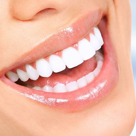 Beautiful Smile Teeth, Perfect Smile Teeth, Natural Teeth Whitening Diy, Pretty Teeth, Kesehatan Gigi, Veneers Teeth, Beautiful Teeth, Teeth Whitening Toothpaste, Teeth Whitening Diy