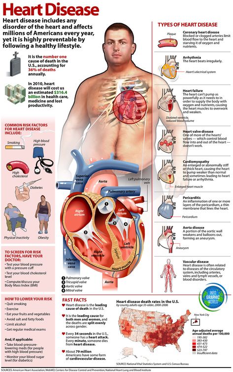 Disease Infographic, Types Of Heart, Cardiac Nursing, Heart And Lungs, Heart Conditions, Nursing Tips, Nursing Study, Nursing Education, Nursing Notes