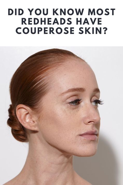 Did You Know Most Redheads Have Couperose Skin? Redhead Cool Skin Tone, Hair For Very Pale Skin, Redhead With Hazel Eyes, Redhead Color Analysis, Colors For Red Heads To Wear, Fair Skin Natural Makeup, Ginger Hair On Cool Skin, Cool Skin Red Hair, Best Clothing Colors For Gingers