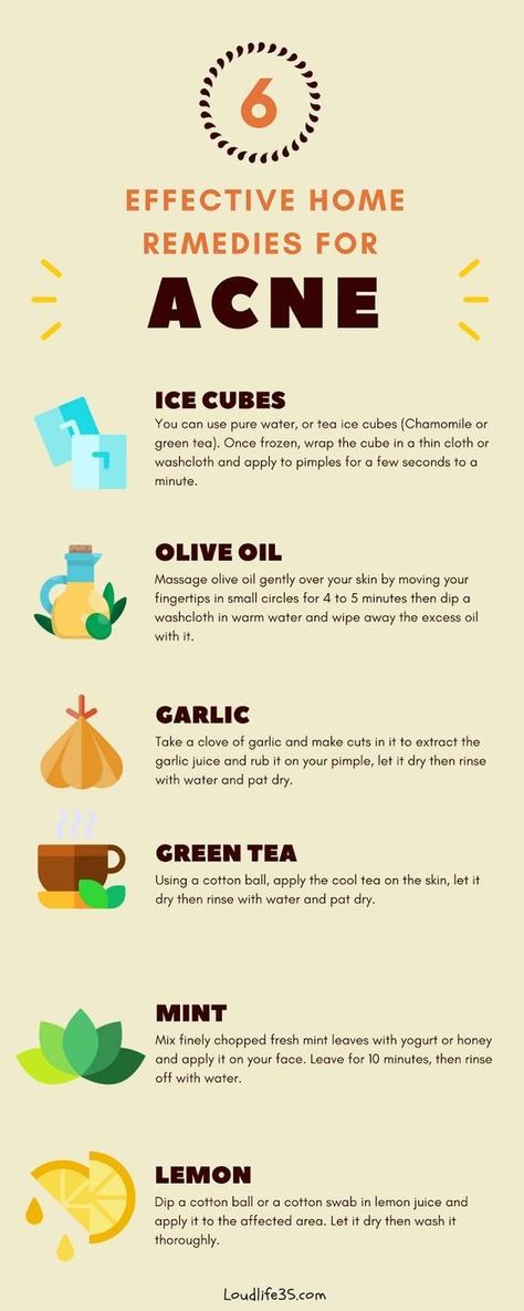 Acne Overnight, Pimples Overnight, Diy Acne, Natural Acne, How To Remove Pimples, Types Of Acne, Acne Problem, Healing Waters, How To Get Rid Of Pimples