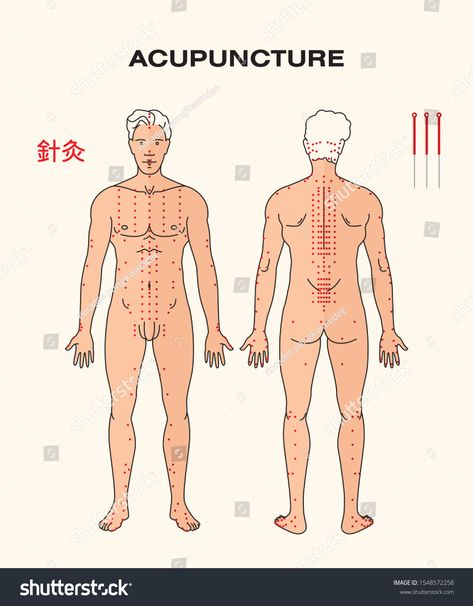 ACUPUNCTURE on human body (with red point) #Ad , #AFFILIATE, #human#ACUPUNCTURE#body#point Human Body, Acupuncture, Infographic Templates, Royalty Free Stock Photos, Stock Images, Stock Photos, Human, Red
