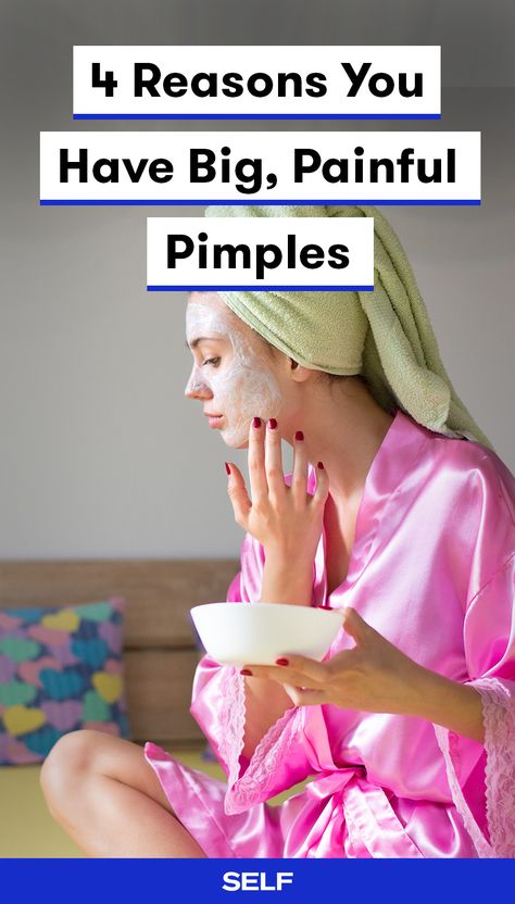 Unlike whiteheads or blackheads, cystic acne (which causes big, painful pimples) isn't caused by using the wrong products or not exfoliating enough. The causes are truly more than skin deep. Here are the most likely things that are triggering your cystic acne—and how to address it once and for all. Severe Acne Remedies, Painful Pimple, Treating Cystic Acne, Cystic Acne Remedies, Haut Routine, Pimples Remedies, Natural Acne, Natural Acne Remedies, Acne Causes