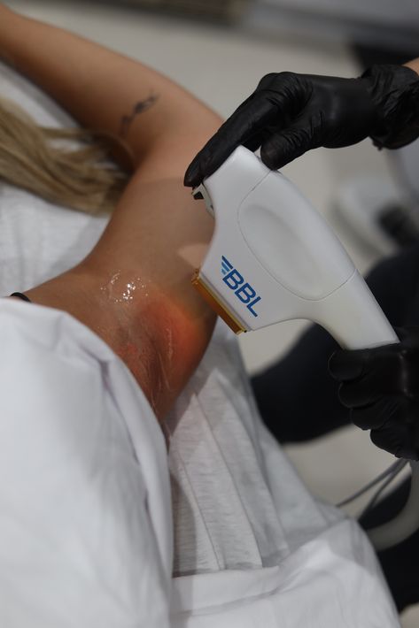 Laser Technician Aesthetic, Laser Hair Removal Aesthetic, Profractional Laser, Laser Technician, Laser Aesthetic, Target Skincare, Laser Depilation, Laser Spa, Esthetician Inspiration