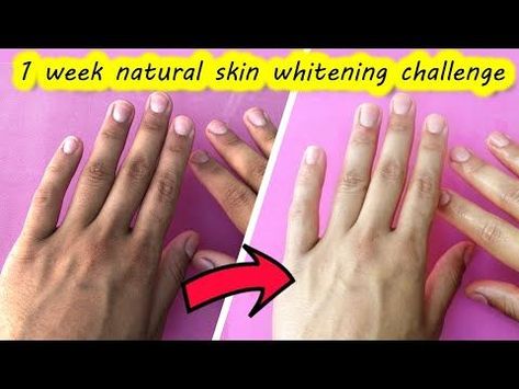 Face Whiting Home Tips, Body Whiting Products, How To Brighten Your Hands, Clear Hand Skin, White Face Tips, How To Make Your Skin White Natural, How To Whiten Your Face Naturally, How To Get White Hands Naturally, Face Brightness Tips