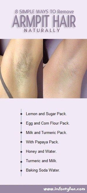 8 Homemade Natural Tips To Remove Armpit Hair At Home | #Homemade #Natural #Tips  #Remove #Armpit #Hair Remove Body Hair Permanently, Hair Removal Diy, Best Hair Removal Products, Unwanted Hair Permanently, Remove Unwanted Facial Hair, Unwanted Hair Growth, Underarm Hair Removal, Dark Underarms, Unwanted Facial Hair