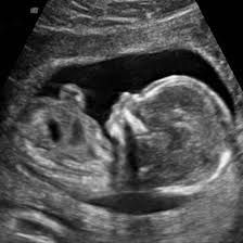How to Store Ultrasound Photos Baby Ultrasound Pictures, Baby Weeks, Pregnancy Ultrasound, Baby Ultrasound, Development Milestones, Ultrasound Pictures, Baby Scan, Fetal Development, Unborn Baby