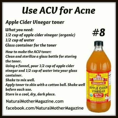 ACV facial toner Acv For Acne, Acv Toner, Apple Cider Vinegar Toner, Apple Cider Vinegar Uses, Apple Cider Vinegar Acne, Apple Cider Vinegar For Skin, Apple Cider Vinegar Benefits, Apple Cider Benefits, Skin Tags
