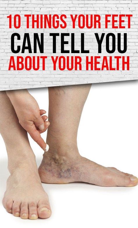 Knowing and understanding what your feet say about your health can really help you to learn more about your body. Foot Reflexology Massage, Baking Soda Benefits, Health Articles Wellness, Reflexology Massage, Poor Circulation, Health Signs, Foot Reflexology, Healing Touch, Healthy Liver