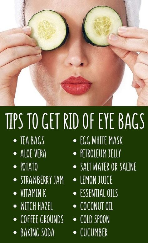 Skin Care Remedies, Get Rid Of Eye Bags, Rid Of Eye Bags, Remove Eye Bags, Eye Skin Care, Dark Circles Under Eyes, Under Eye Bags, Beauty Remedies, Skin Care Recipes