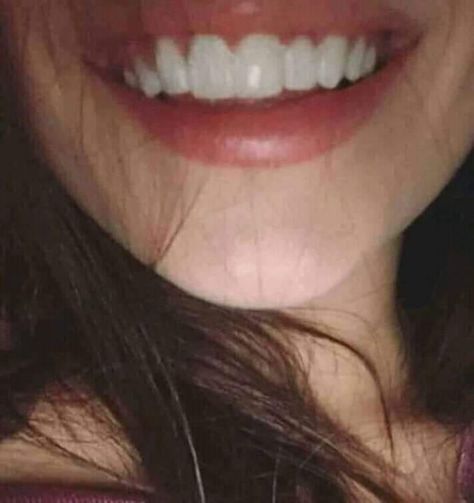 This is more beautiful than showing chest or ass <3 Beautiful Smile Teeth, Teeth Aesthetic, Pretty Teeth, Beautiful Teeth, Straight Teeth, Perfect Teeth, Dream Vision Board, Life Vision Board, Smile Teeth