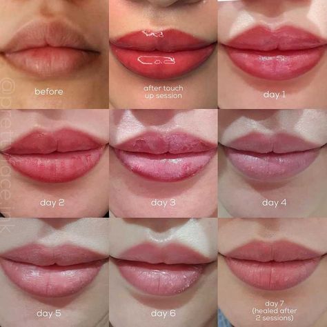 Lip Blush Healing Process - Day by Day Timeline and Stages Lip Blushing Tattoo Healing Stages, Glossy Ombre Lips, Pmu Lips Healing Process, Lip Tattoo Healing Process, Lip Blushing Healing Process, Lip Blushing Tattoo Before And After Colors, Lipblush Before And After, Lip Filler Healing Stages, Healed Lip Blush
