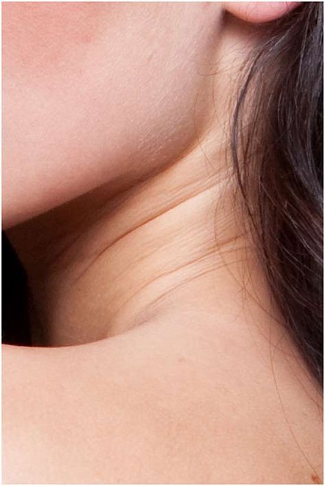 How to Prevent Neck Wrinkles? Neck Exercise, Diy Scrubs, Potato Slices, Homemade Wrinkle Cream, Neck Exercises, Neck Wrinkles, Get Rid Of Blackheads, Sun Exposure, Beauty Remedies