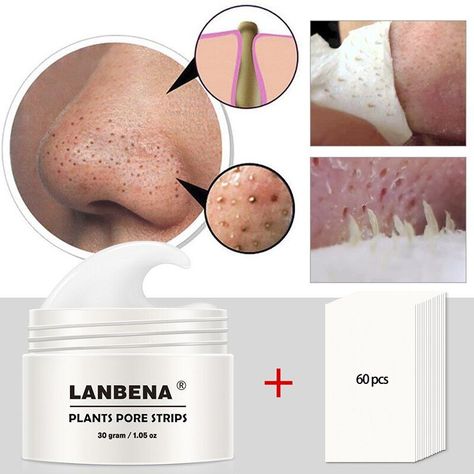 Armpit Rash, Nose Pore Strips, Black Head Remover Mask, Face Mask For Pores, Nose Pores, Blackheads On Nose, Pore Strips, Nose Mask, Nose Strips