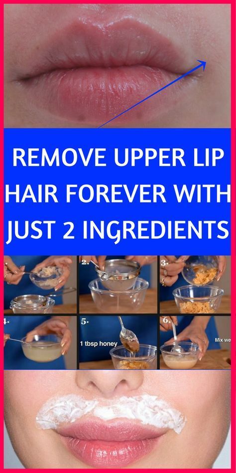 how to remove upper lip hair forever with just 2 ingredients - step by step instructions
