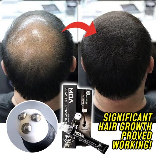 Hair Growth Products, Dunner Wordend Haar, Hair Removal Spray, Simpsons Funny, Thicker Healthier Hair, Hair Growth Secrets, Smink Inspiration, Regrow Hair, Hair Growth Serum