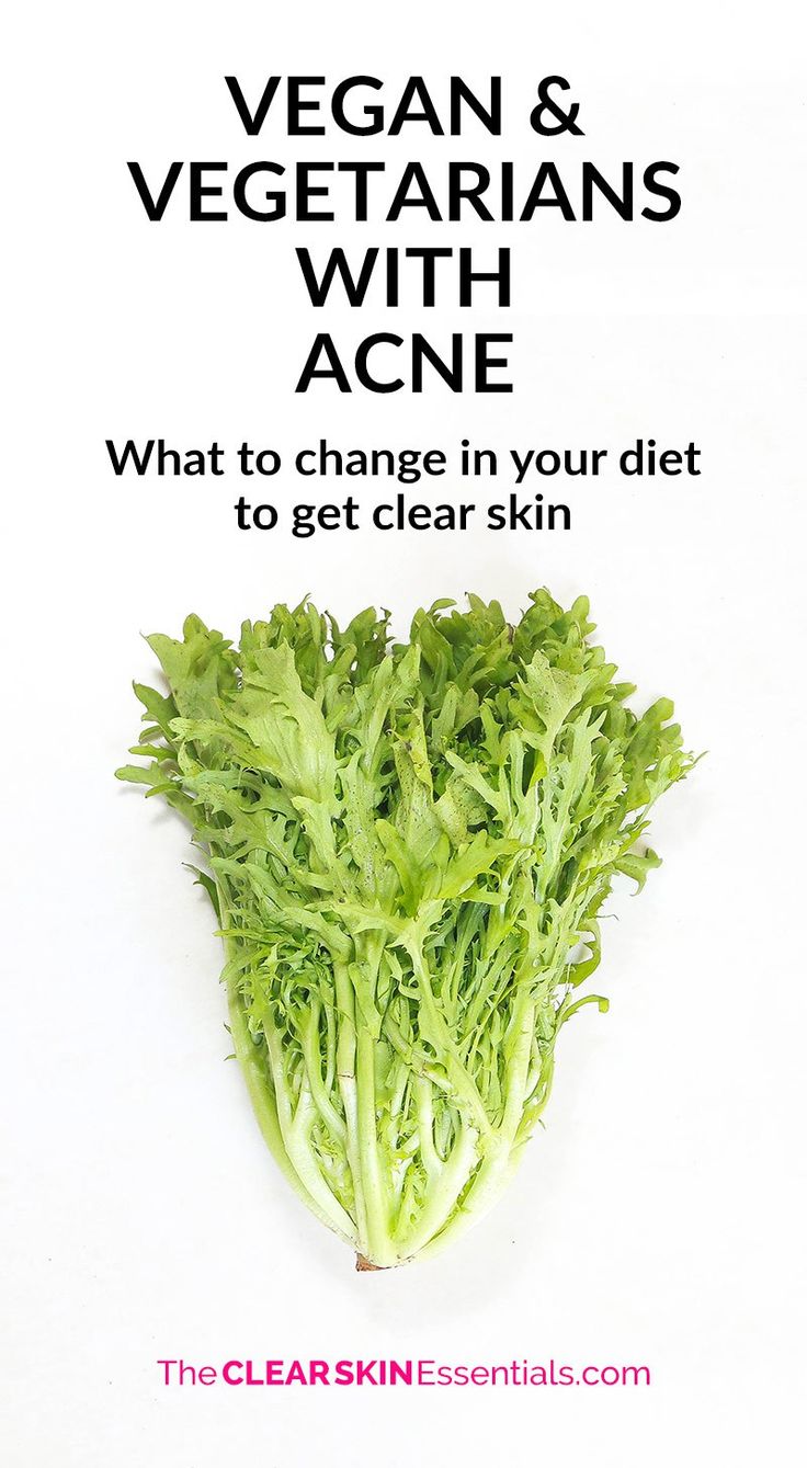 Are you a vegetarian or vegan and struggling with acne? Here's my top 3 tips on what to change and adjust in your diet to start clearing up your skin now. | www.TheClearSkinEssentials.com #acne #veganacne #vegetarianacne Acne Free Diet, Clear Skin Diet, Food For Glowing Skin, Anti Aging Skin Care Diy, Essential Oil Skin Care, Skin Diet, Natural Acne Remedies, Natural Acne, Skin Clear