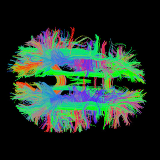 fmri graphic