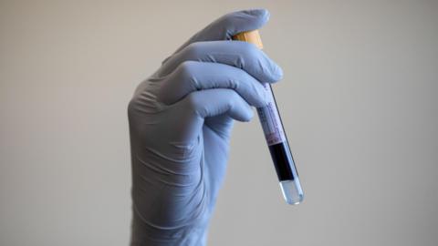 A paramedic holding a test tube containing a blood sample