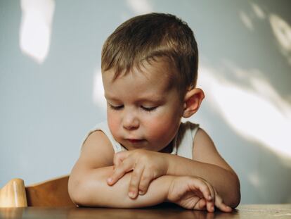 La alergia puede aparecer a cualquier edad y con síntomas muy variados.