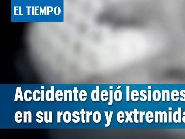 Lesionada en accidente pide que encuentren al responsable. La Policía no informó sobre quién la atropelló.