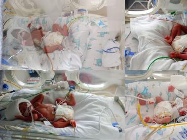 Melani, Yuliana, Nashly y Aylen nacieron a eso de las 4: 30 de la mañana del 18 de julio.